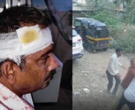 53-year-old man injured after stone attack during two-wheeler dispute