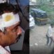 53-year-old man injured after stone attack during two-wheeler dispute