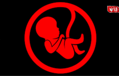 Abortion