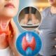 Thyroid and Weight Gain