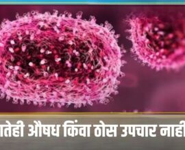 Chandipura Virus